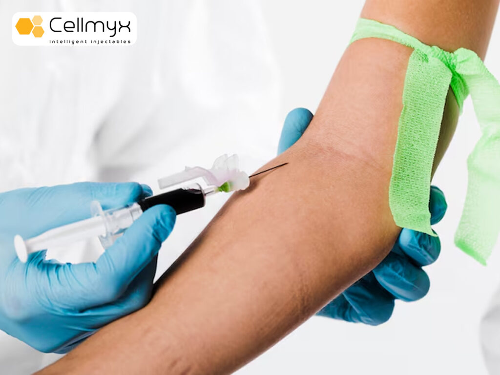 Tumescent Infiltration Cannula